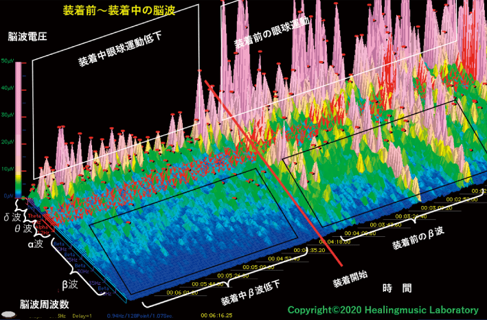 装着前〜装着中の脳波